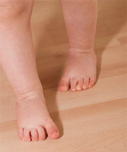 physical-therapy-children-gait